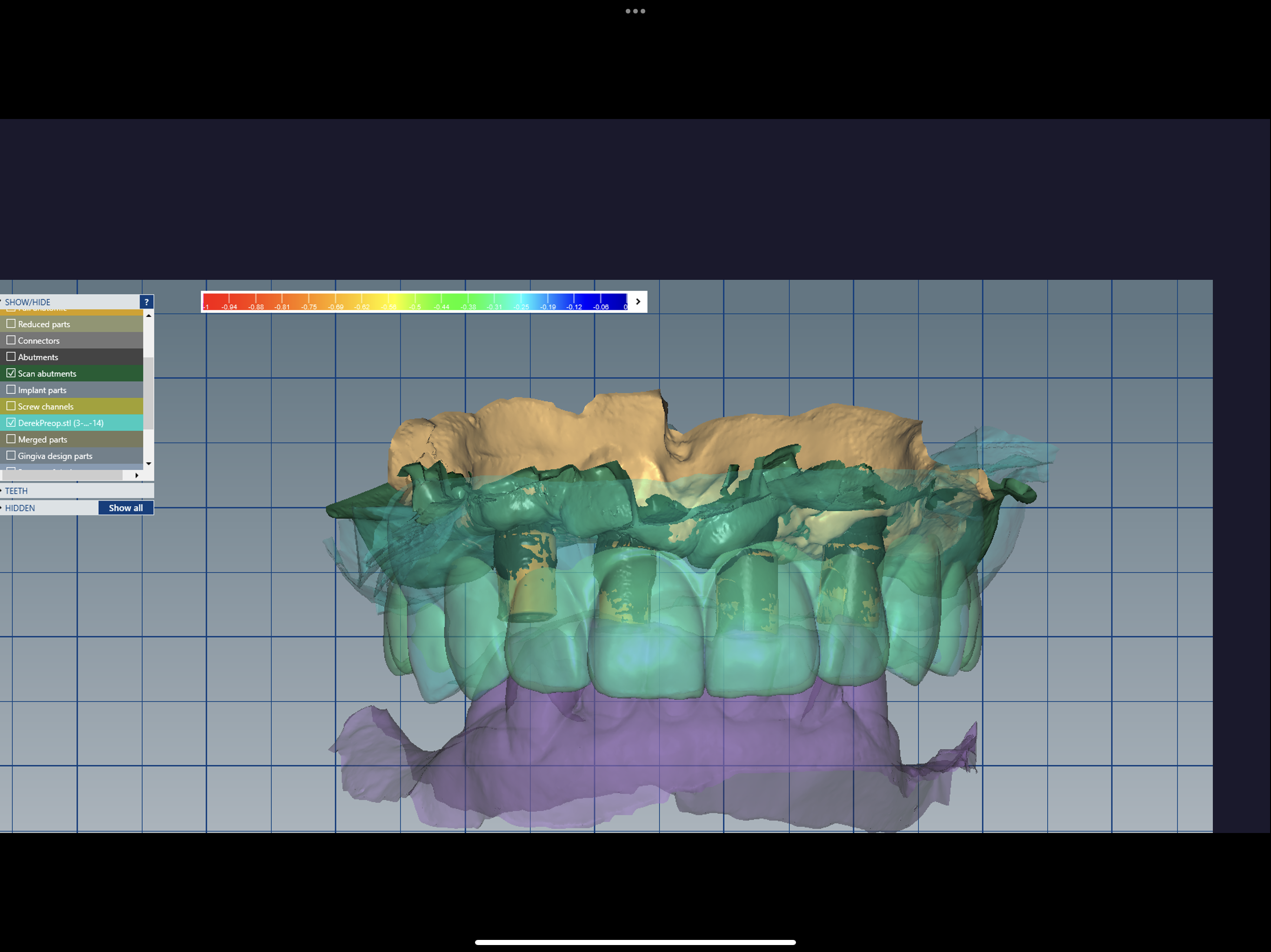 Dental Innovation and Excellence | Spectrum Dental Science Inc